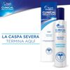 Clinical-Solutions-Shampoo-para-Caspa-Severa-130ml-imagen-3