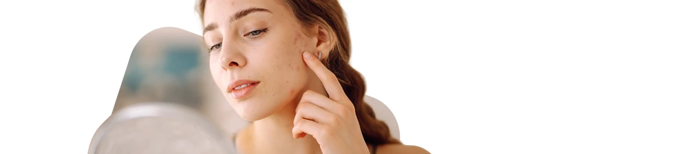 Persona con manchas en la cara viéndose al espejo